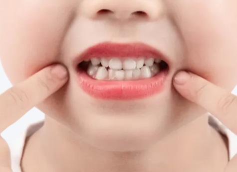 涂氟后多久能刷牙？河北惟德口腔醫(yī)生專業(yè)答疑