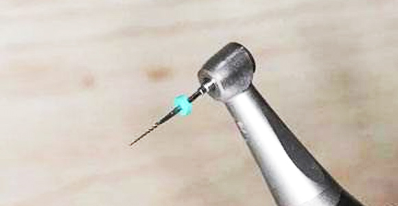 精細切割，極大程度保留牙神經(jīng)，根管治療成功率極高