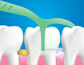 口腔問題可能要“命”！5大預(yù)警信號(hào)，別忽視