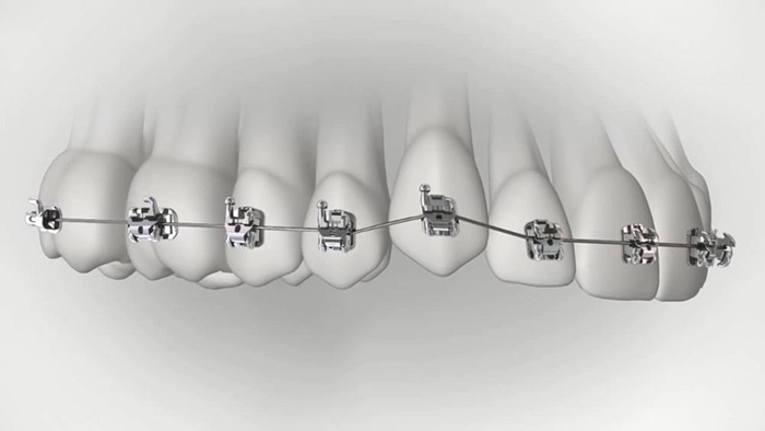 承德市哪家口腔醫(yī)院口腔正畸做得好？惟德口腔醫(yī)院來告訴您