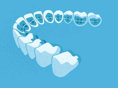 惟德口腔醫(yī)院口腔正畸好不好？