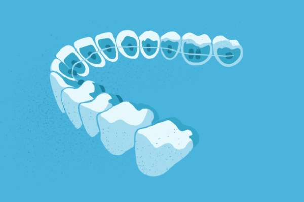 惟德口腔醫(yī)院口腔正畸好不好？